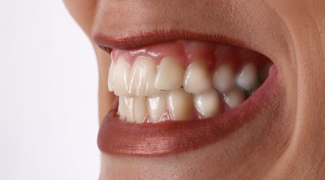 Nächtliches Zähneknirschen - ein Symptom von Ängsten und Sorgen? (© djma / Fotolia)