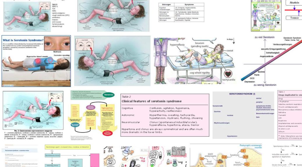 Serotonin-Syndrom (Google Bilder Suche)